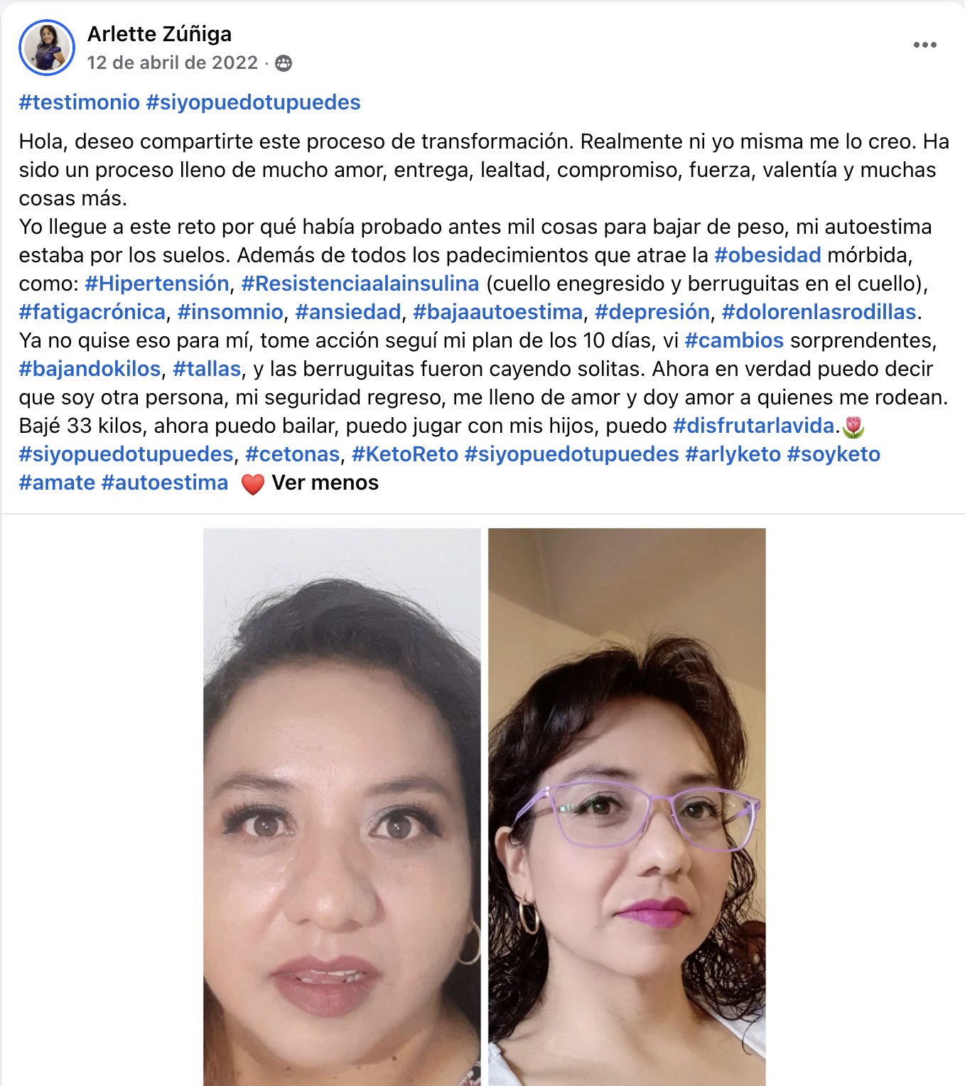 Testimonio de Arlette Zúñiga, antes y después con Keto Reto