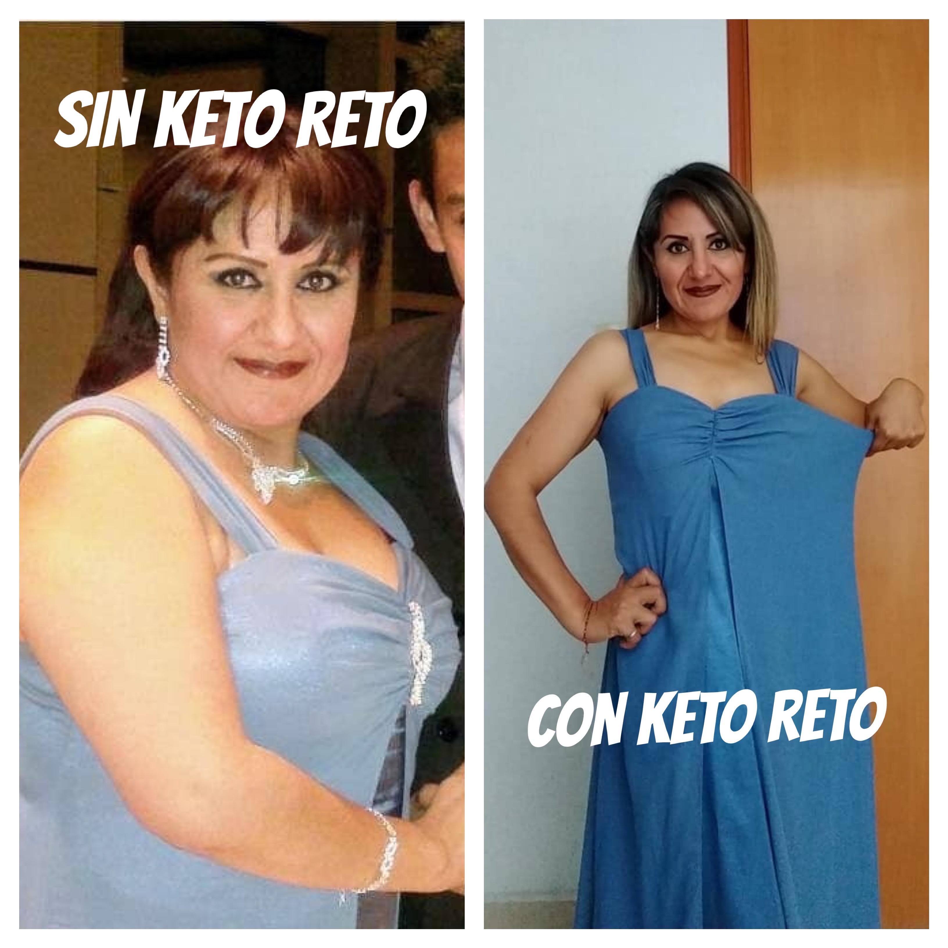 Testimonio sin Keto Reto y con Keto Reto de una clienta con vestido azul